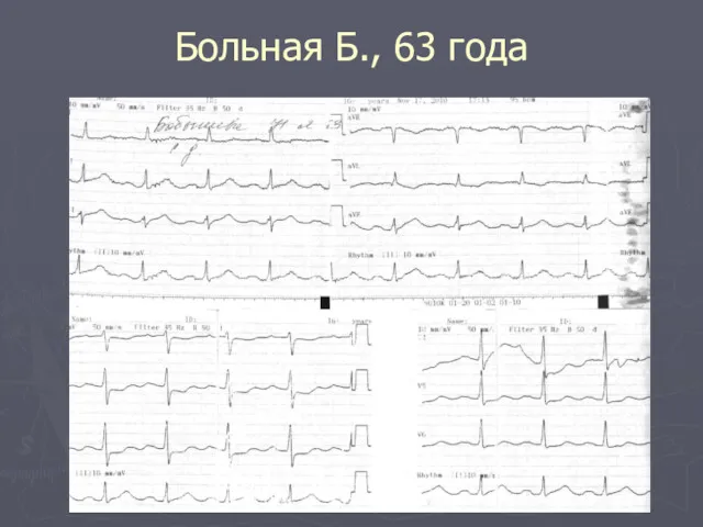 Больная Б., 63 года