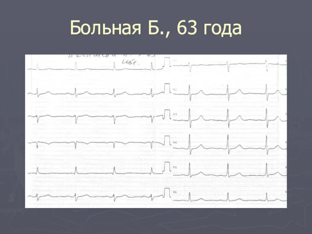 Больная Б., 63 года