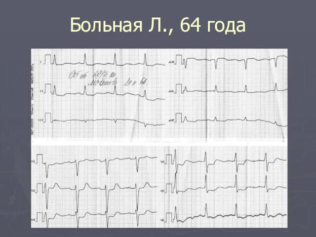 Больная Л., 64 года