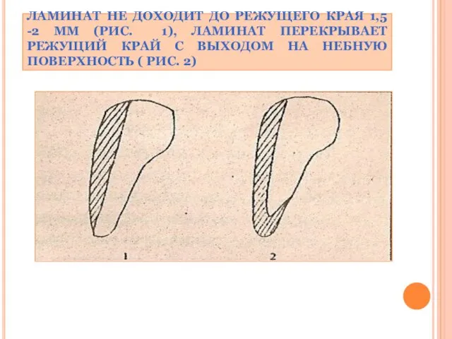 ЛАМИНАТ НЕ ДОХОДИТ ДО РЕЖУЩЕГО КРАЯ 1,5 -2 ММ (РИС.