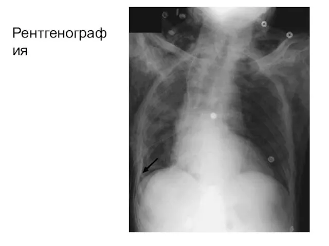 Рентгенография