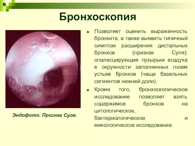 Бронхоскопия Позволяет оценить выраженность бронхита, а также выявить типичный симптом