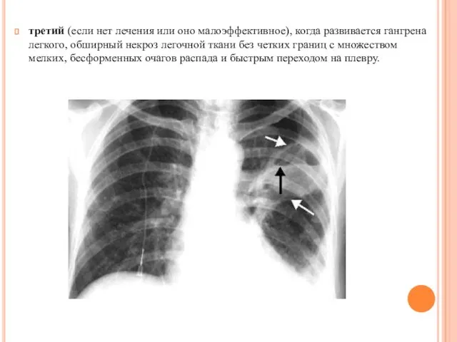 третий (если нет лечения или оно малоэффективное), когда развивается гангрена