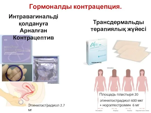 Гормоналды контрацепция. Площадь пластыря 20 см2 Этинилэстрадиол 2.7 мг + этоногестрел 11.7 мг