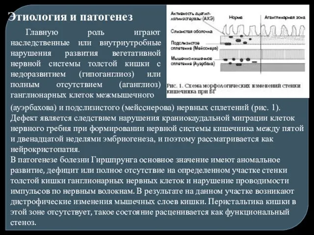 Этиология и патогенез Главную роль играют наследственные или внутриутробные нарушения