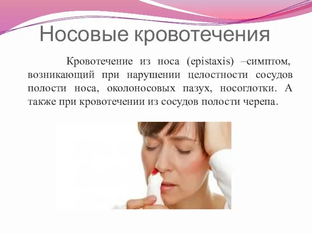 Носовые кровотечения Кровотечение из носа (epistaxis) –симптом, возникающий при нарушении