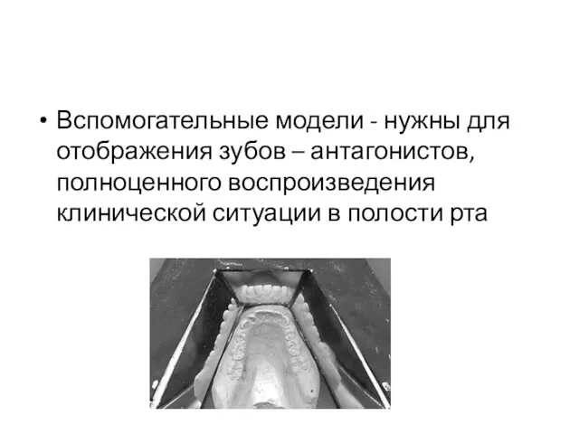 Вспомогательные модели - нужны для отображения зубов – антагонистов, полноценного воспроизведения клинической ситуации в полости рта