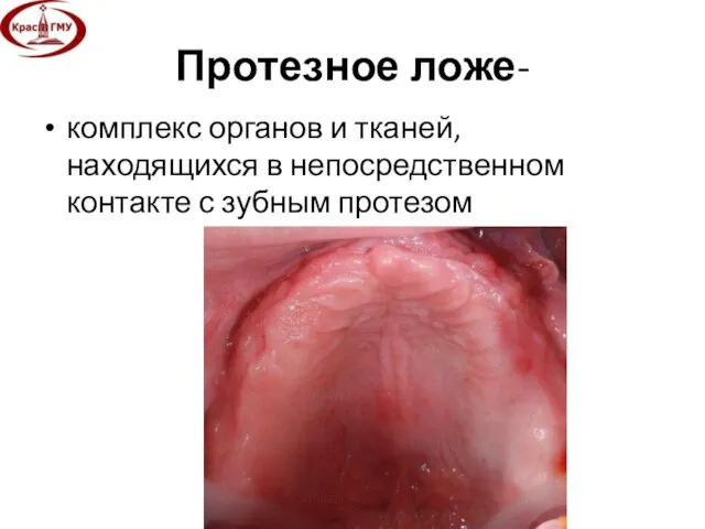 Протезное ложе- комплекс органов и тканей, находящихся в непосредственном контакте с зубным протезом