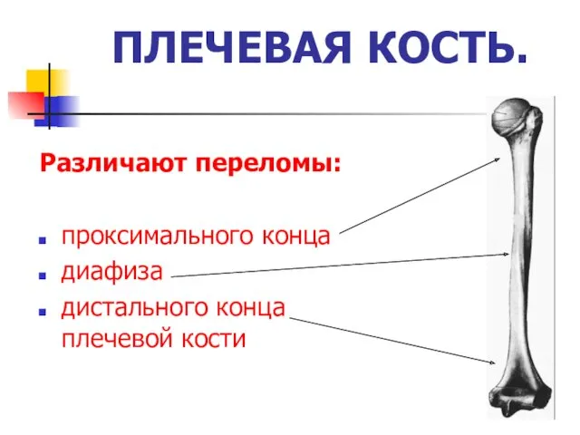 ПЛЕЧЕВАЯ КОСТЬ. Различают переломы: проксимального конца диафиза дистального конца плечевой кости