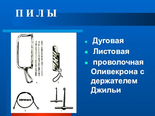 П И Л Ы Дуговая Листовая проволочная Оливекрона с держателем Джильи