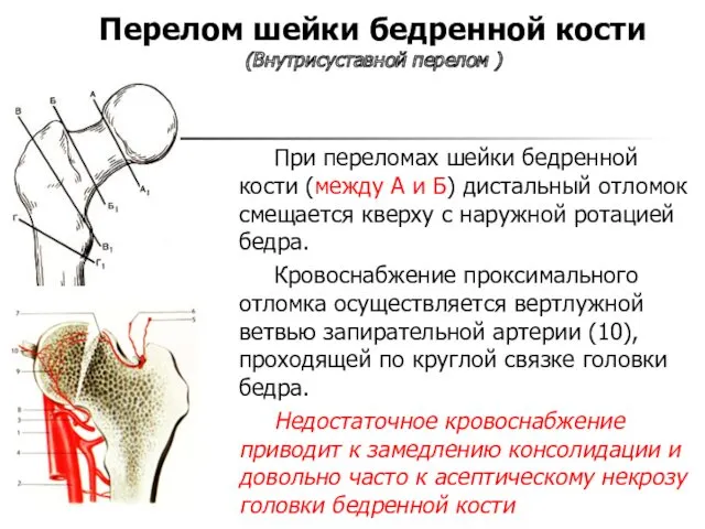 Перелом шейки бедренной кости (Внутрисуставной перелом ) При переломах шейки