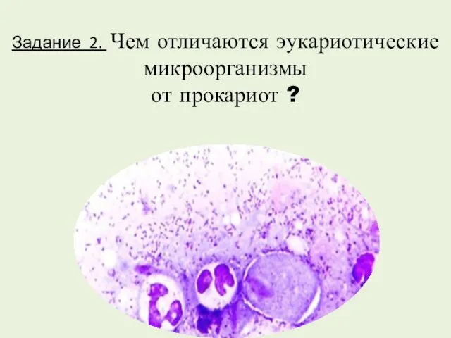 Задание 2. Чем отличаются эукариотические микроорганизмы от прокариот ?