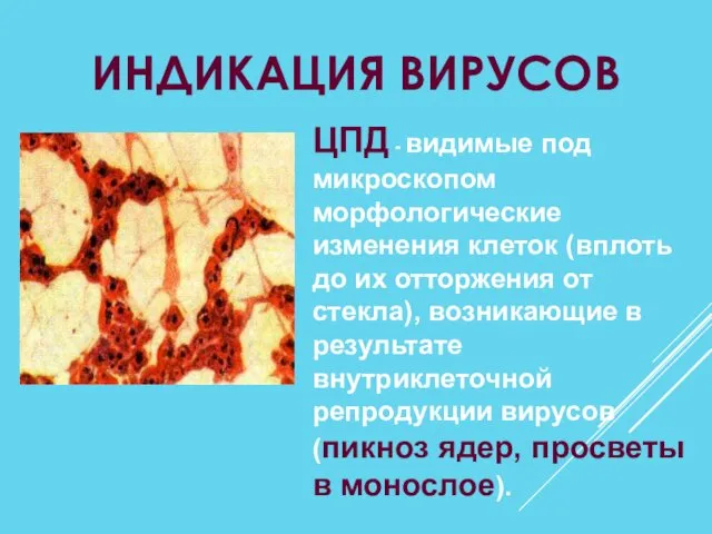 ИНДИКАЦИЯ ВИРУСОВ ЦПД - видимые под микроскопом морфологические изменения клеток (вплоть до их