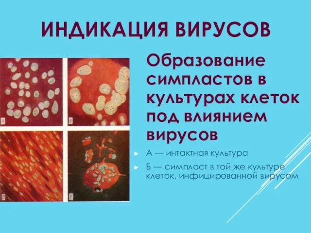 ИНДИКАЦИЯ ВИРУСОВ Образование симпластов в культурах клеток под влиянием вирусов А — интактная