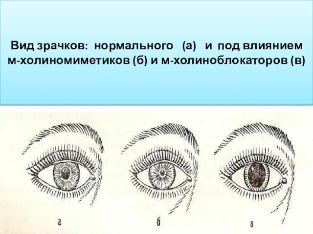 Вид зрачков: нормального (а) и под влиянием м-холиномиметиков (б) и м-холиноблокаторов (в)