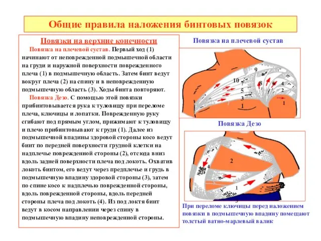 Общие правила наложения бинтовых повязок Повязки на верхние конечности Повязка на плечевой сустав.