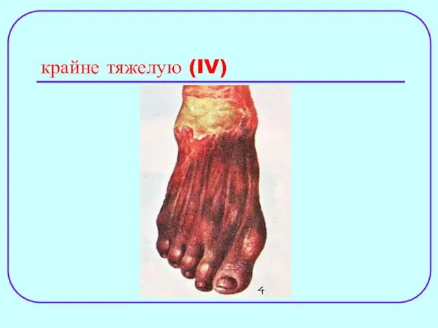 крайне тяжелую (IV)