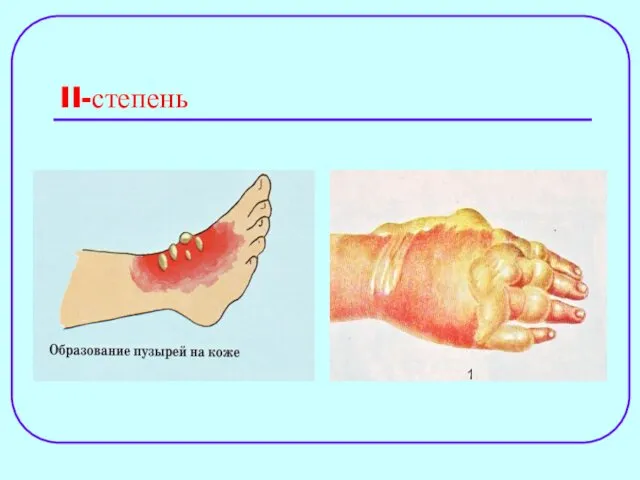 II-степень