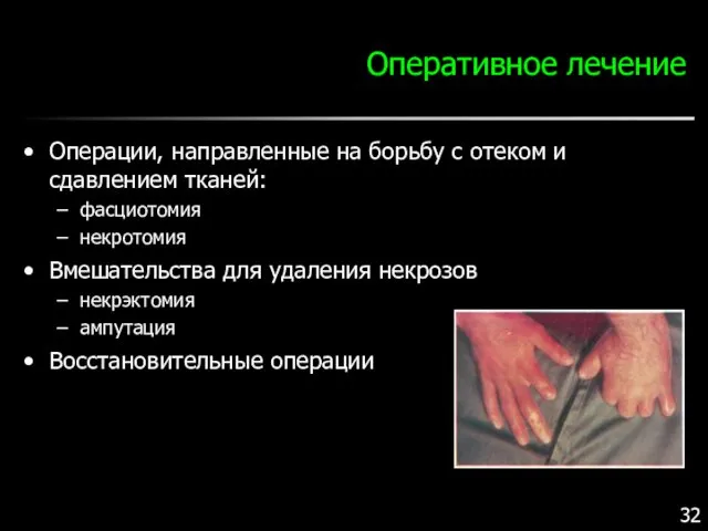 Оперативное лечение Операции, направленные на борьбу с отеком и сдавлением