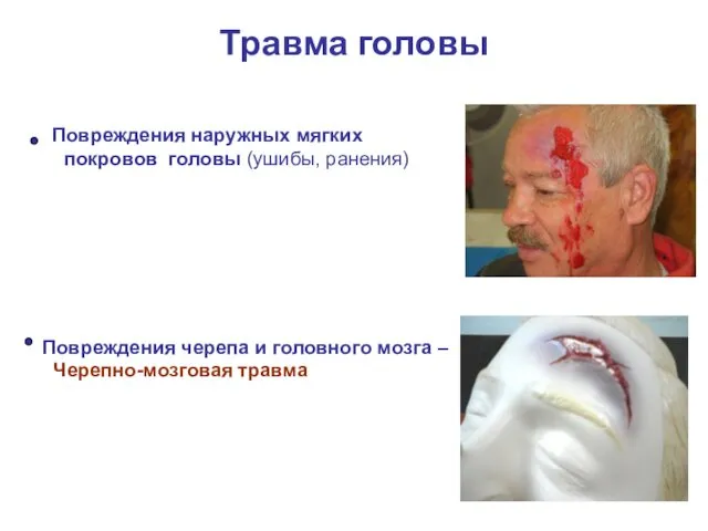 Травма головы Повреждения наружных мягких покровов головы (ушибы, ранения) Повреждения