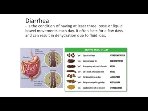 Diarrhea - is the condition of having at least three