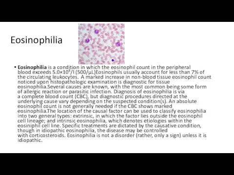 Eosinophilia Eosinophilia is a condition in which the eosinophil count