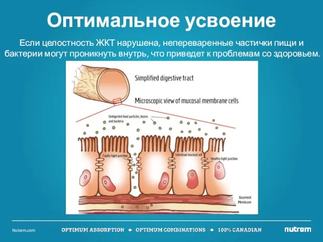 Если целостность ЖКТ нарушена, непереваренные частички пищи и бактерии могут