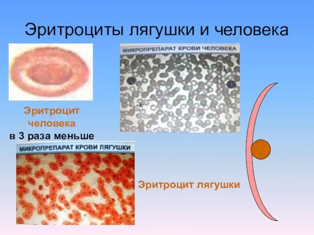 Эритроциты лягушки и человека Эритроцит лягушки Эритроцит человека в 3 раза меньше