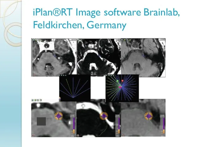 iPlan®RT Image software Brainlab, Feldkirchen, Germany