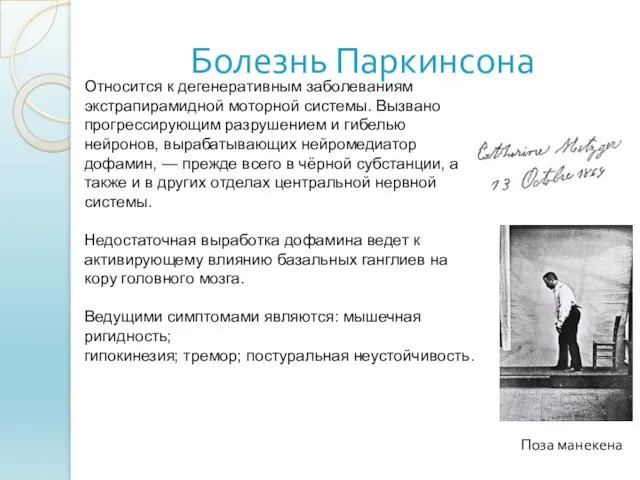 Болезнь Паркинсона Поза манекена Относится к дегенеративным заболеваниям экстрапирамидной моторной