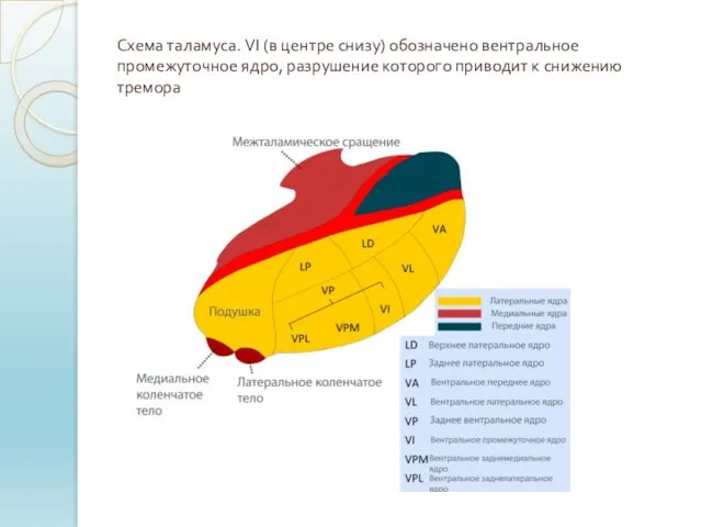 Схема таламуса. VI (в центре снизу) обозначено вентральное промежуточное ядро, разрушение которого приводит к снижению тремора