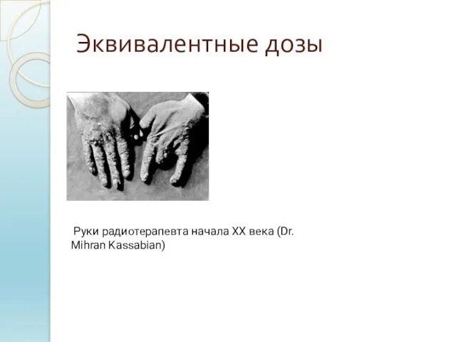 Эквивалентные дозы Руки радиотерапевта начала ХХ века (Dr. Mihran Kassabian)