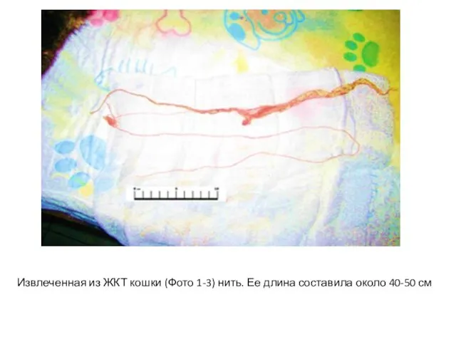 Извлеченная из ЖКТ кошки (Фото 1-3) нить. Ее длина составила около 40-50 см