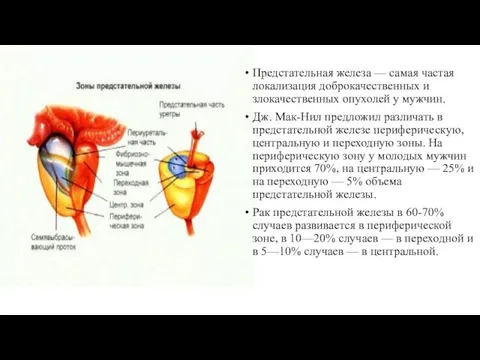 Предстательная железа — самая частая локализация доброкачественных и злокачественных опухолей