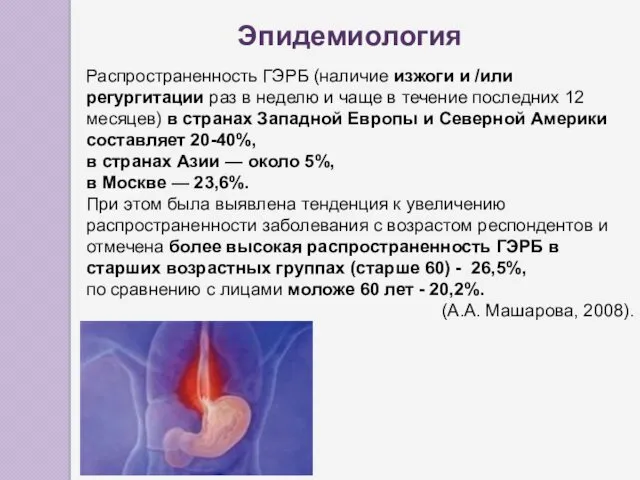 Распространенность ГЭРБ (наличие изжоги и /или регургитации раз в неделю