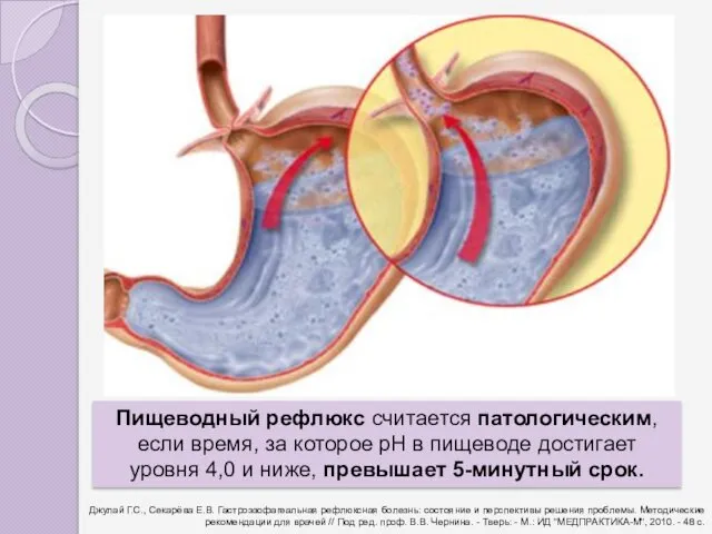 Джулай Г.С., Секарёва Е.В. Гастроэзофагеальная рефлюксная болезнь: состояние и перспективы