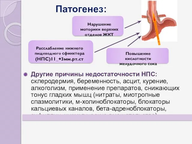 Патогенез: Другие причины недостаточности НПС: склеродермия, беременность, асцит, курение, алкоголизм,