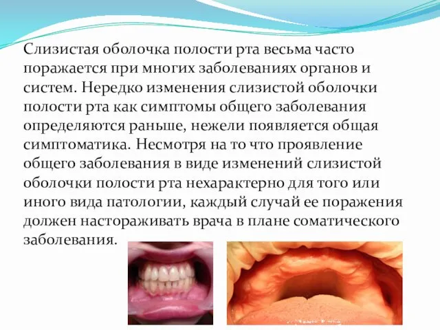 Слизистая оболочка полости рта весьма часто поражается при многих заболеваниях