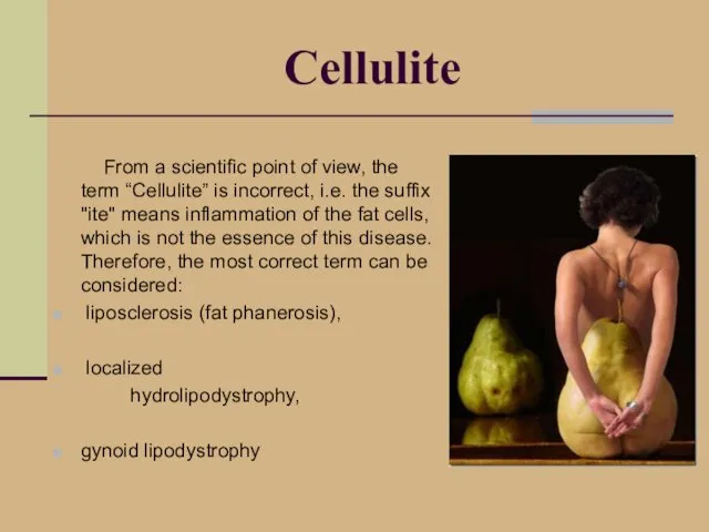 Cellulite From a scientific point of view, the term “Cellulite”