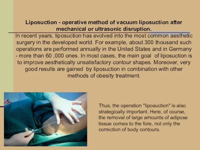 Liposuction - operative method of vacuum liposuction after mechanical or