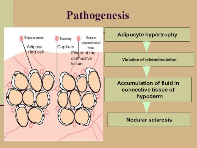 Pathogenesis Violation of microcirculation Accumulation of fluid in connective tissue