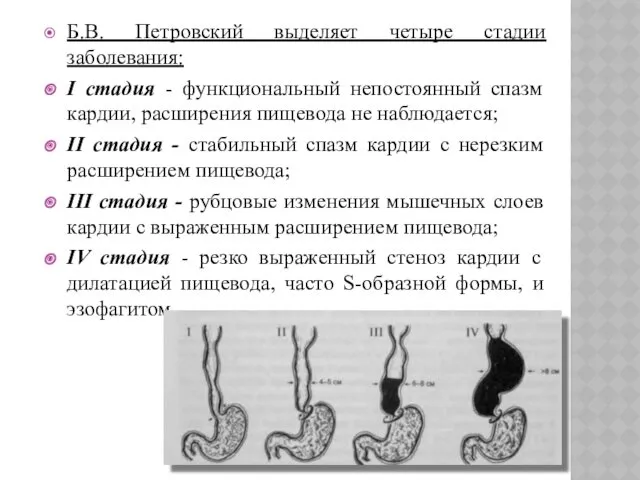 Б.В. Петровский выделяет четыре стадии заболевания: I стадия - функциональный