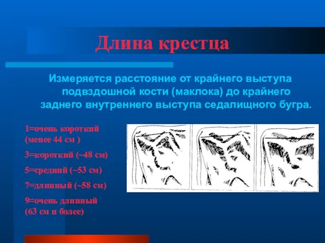 Длина крестца Измеряется расстояние от крайнего выступа подвздошной кости (маклока)