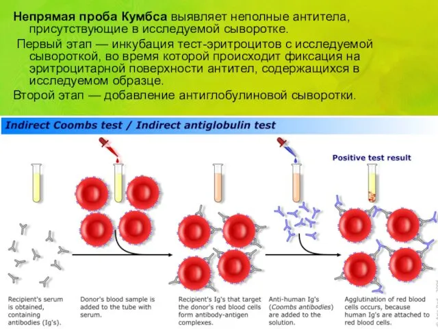 Непрямая проба Кумбса выявляет неполные антитела, присутствующие в исследуемой сыворотке.