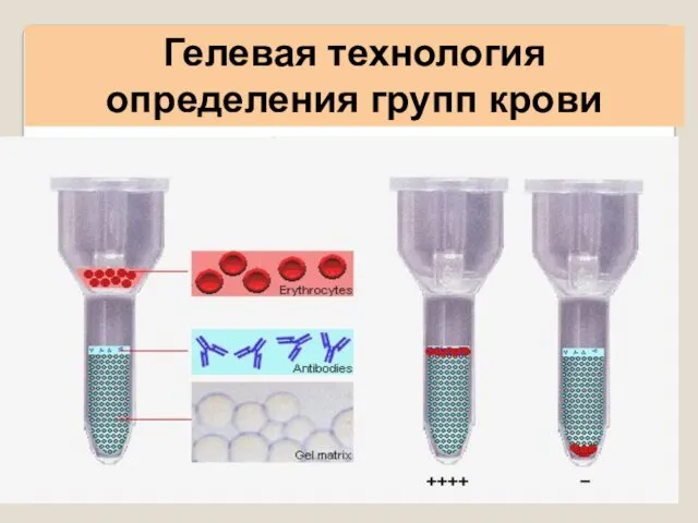 Гелевая технология определения групп крови