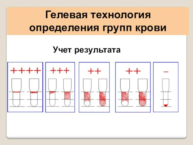 Гелевая технология определения групп крови Учет результата