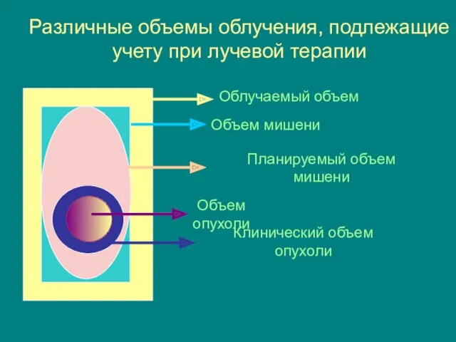 Различные объемы облучения, подлежащие учету при лучевой терапии Объем опухоли