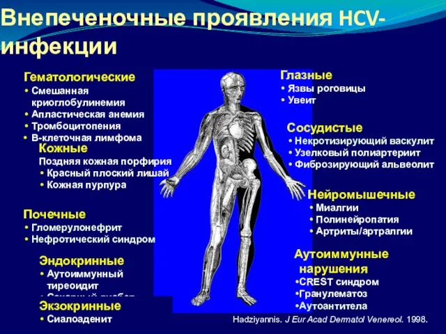 Hadziyannis. J Eur Acad Dermatol Venereol. 1998. Внепеченочные проявления HCV-инфекции