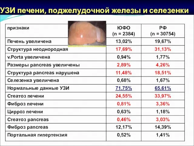 УЗИ печени, поджелудочной железы и селезенки