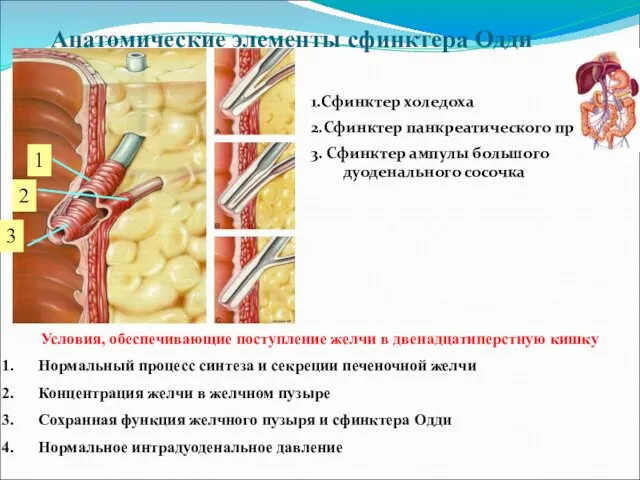 Анатомические элементы сфинктера Одди 1.Сфинктер холедоха 2.Сфинктер панкреатического протока 3.